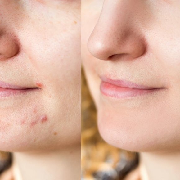 Luxury facial beauty cleanser soft silicone head double sided - Picture 5 of 14